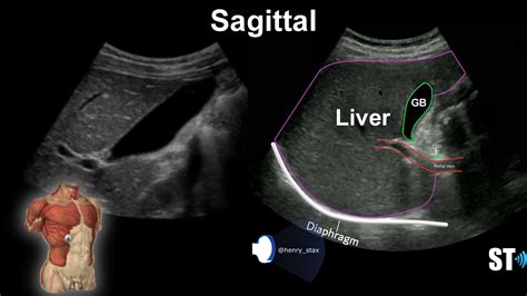 Liver Anatomy And Protocol Sonographic Tendencies