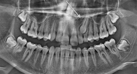 What Is Oral Surgery Hobart Orofacial Pain And Special Needs Clinic