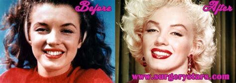 Marilyn Monroe Plastic Surgery Before After Pic