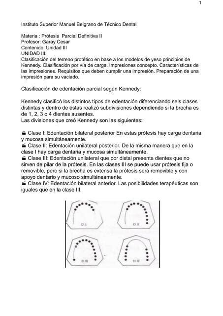 Prótesis Parcial definitiva Cesar Garay uDocz