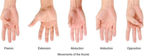 Thumb Arthritis Causes Symptoms Exercises Splint And Treatment