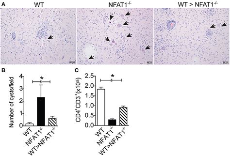 Frontiers Nfat1 Regulates Ly6chi Monocyte Recruitment To The Cns And