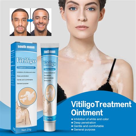 20g Herbal Extract Vitiligo Ointment Remove Ringworm White Spot Removal