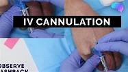 Intravenous (IV) cannulation | OSCE Guide - YouTube