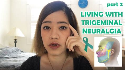 Ep1b Living With Trigeminal Neuralgia My Experience Pre And Post