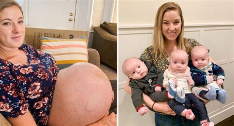 Triplets Mom Shares Amazing Before And After Pregnancy Photos