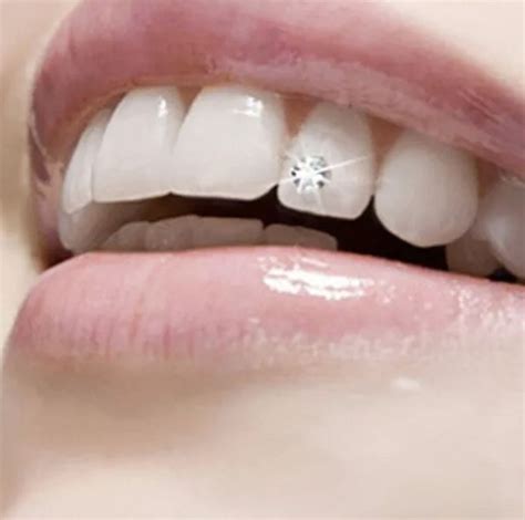 Tooth Diamond Crystal Ornament Teeth Jewelry Lj Healthcare