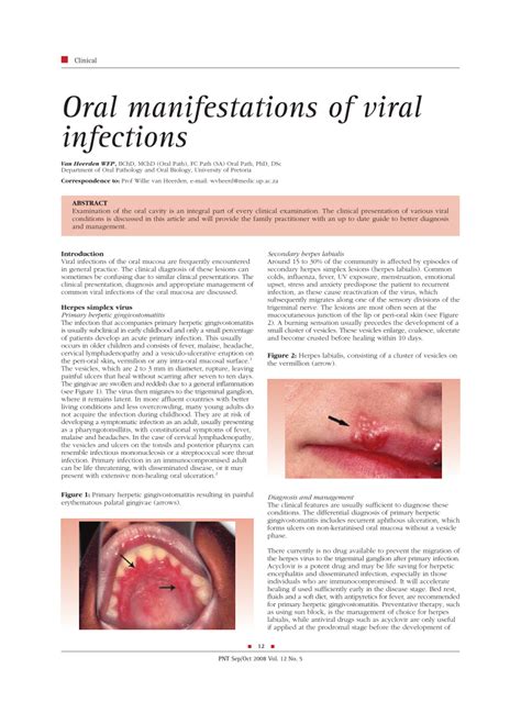Pdf Oral Manifestations Of Viral Infections