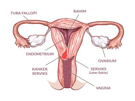 I>a i>a !inspeksi !inspeksi >isual >isual asam asam asetat asetat i>a i>a merupakan tes alternatif skrining untuk kanker serviks. Ganti Pembalut Sehat untuk Cegah Kanker Serviks | Smartmama