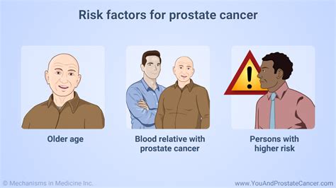 Slide Show Understanding Prostate Cancer