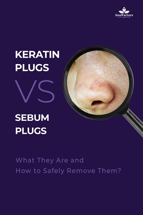 Keratin Plugs Vs Sebum Plugs What They Are And How To Safely Remove