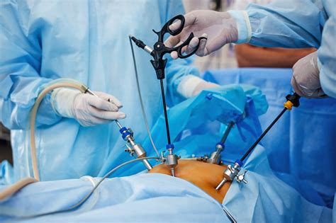 Laparoscopic cholecystectomy has revolutionized the surgical management of gallstone disease but can have increased complications in certain circumstances. Pregnancy after laparoscopy is possible - All Cysts