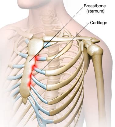 Feeling pain under you left ribs? Causes Of Pain Under Right Rib Cage - Victoria's Glamour