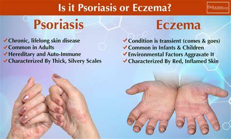 Eczema Symptoms Causes And Support Strategies