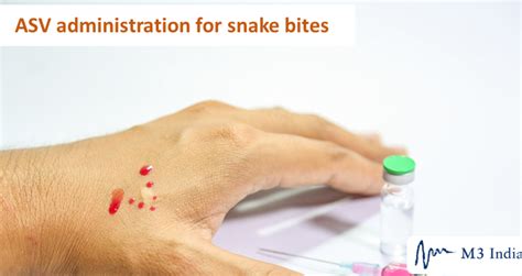 AntiSnake Venom (ASV) administration for snake bites