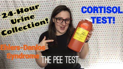 Most of the assay can detect a minimum of 3 mg/dl of protein in the urine. All About Ep. 2 | 24 Hour Urine Test! - YouTube