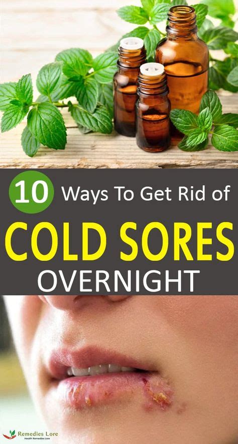 9 Body Ideas Get Rid Of Cold Cold Sores Remedies Cold Sore
