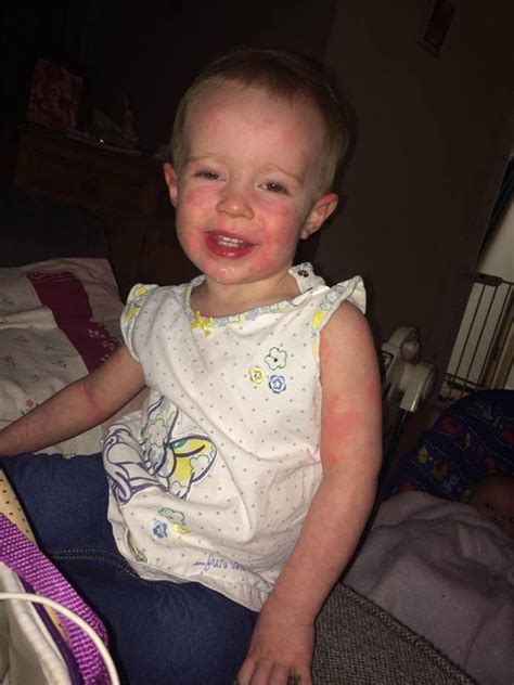 Mums Fury As Baby With Scarlet Fever Turned Away From London Hospital