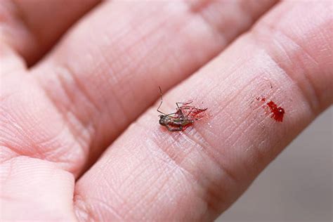 50 Killed Mosquito With Blood On Human Hand Stock Photos Pictures
