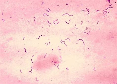 Streptococcus Mutans An Overview Microbe Notes