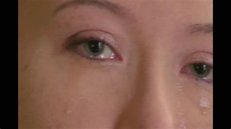 Florida Woman Recently Diagnosed As Allergic To Herself Abc7 New York