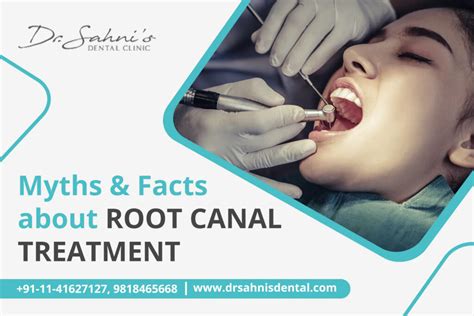 Myths And Facts About Root Canal Treatment Dr Sahni S Dental Clinic
