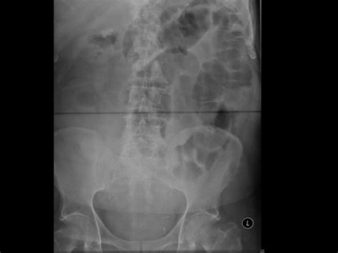 Interpreting Chest And Abdominal Radiographs Mr Jamie Dunn