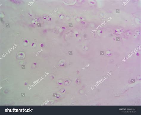 Histology Microscope Image White Fibrocartilage 400x Stok Fotoğrafı