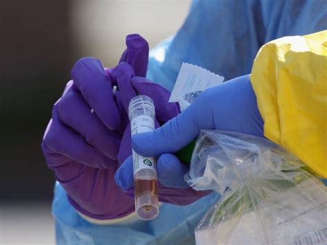 2nd Abbott Labs Coronavirus Antibody Test Gets Emergency Approval
