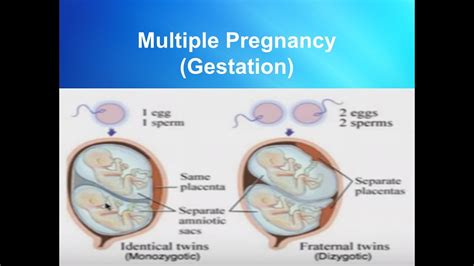 Multiple Pregnancy Gestation Youtube