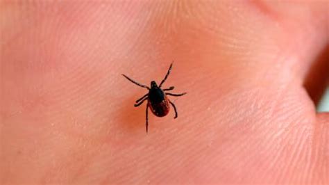 Red Meat Allergy Alert 450k Americans Impacted By Tick Bite Syndrome