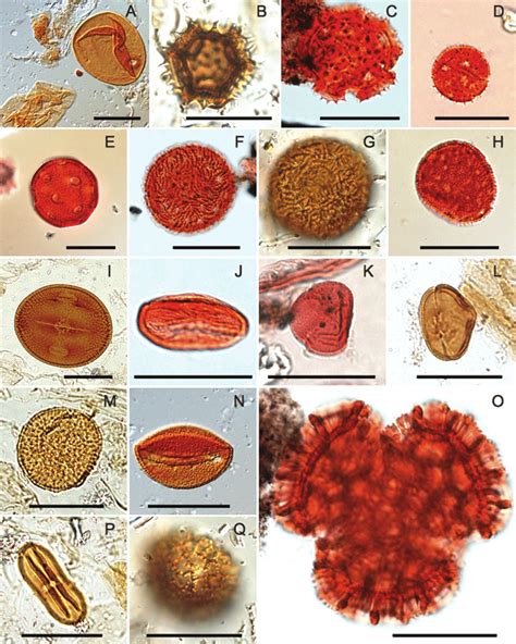 Plate Of Selected Pollen Grains From Unit 3 At Cape Ball Black Scale