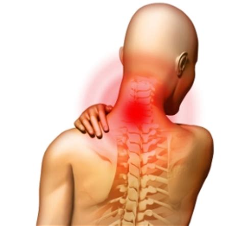 Neck muscles help support the cervical spine and contribute to movements of the head, neck, upper back, and posterior longitudinal ligament (pll). Medial Branch Blocks — ACPC
