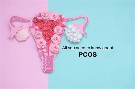 Polycystic Ovary Syndrome Pcos Apollo Cradle