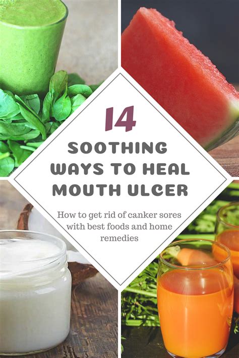 14 Soothing Home Remedies And Best Foods To Heal Mouth Ulcer