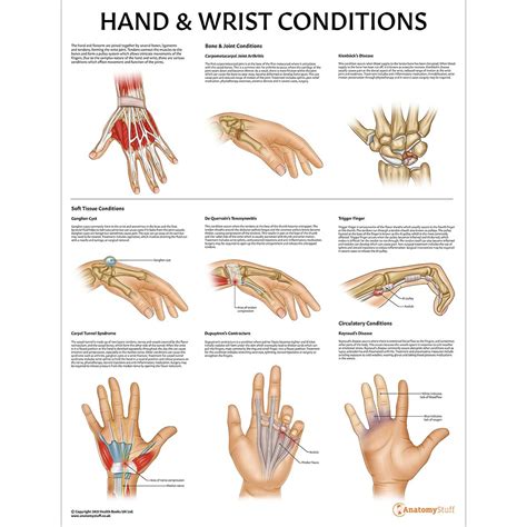 Hand And Wrist Chart Ph