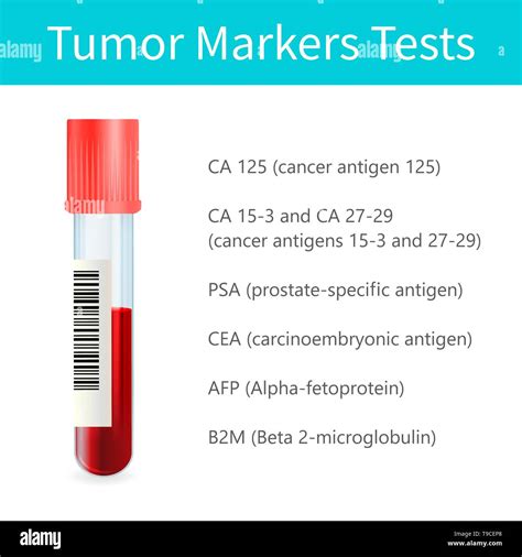 Cancer Marker Blood Test Illustration Stock Photo Alamy