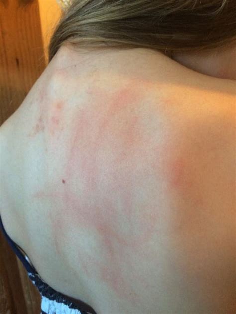 Girl 7 Terrified Of School After Being Kicked Punched And Spat At