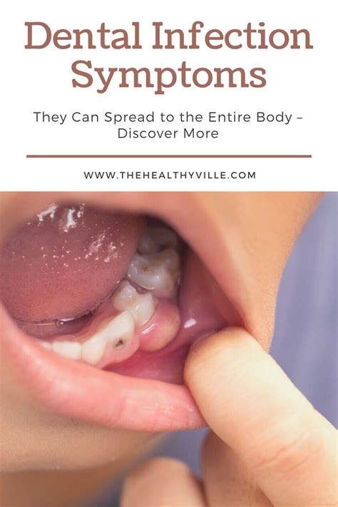 Dental Infection Symptoms Can Spread To The Entire Body Discover More