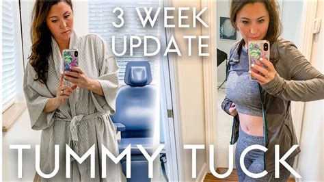 Tummy Tuck 3 Week Update Before And After Pictures Full Experience