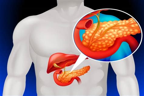 Pancrease Functions Location And Disorders And More Health4fitness