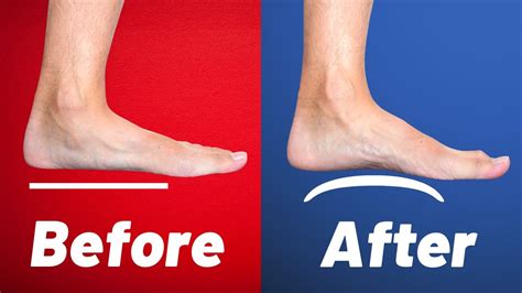 How To Fix Flat Feet 3 Simple Exercises From A Physical Therapist Youtube