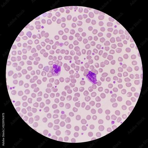 Fototapeta The Peripheral Blood Smear Shows Eosinophil Basophil
