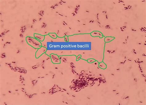 Gram Positive Bacteria Gram Stain Introductionprinciple Procedure