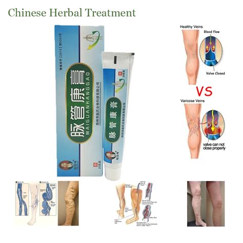 Varicose Veins Ointment Eins Varicose Treatment Plaster Varicose Veins