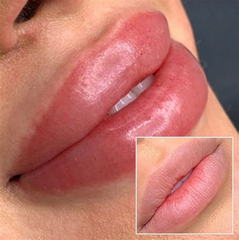 All You Need To Know About Permanent Lip Makeup