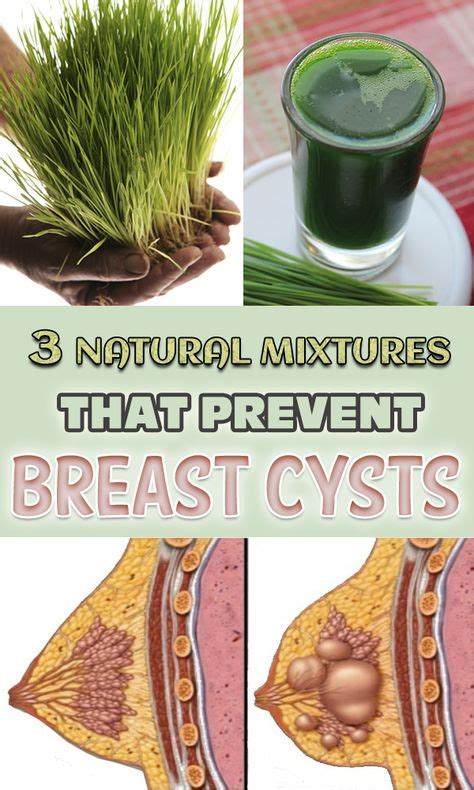 Remedies For Breast Cysts