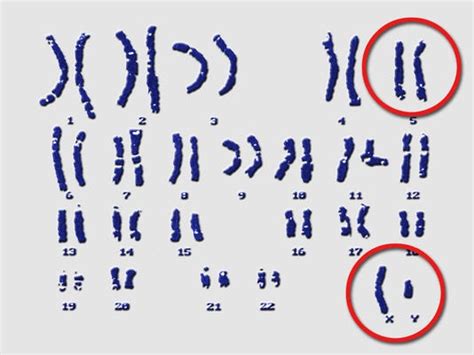 Gene Detectives Id Anonymous Men In Registry