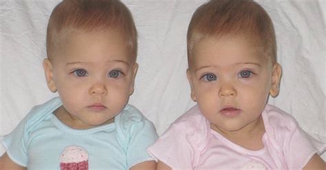 Identical Sisters Born In 2010 Have Grown Up To Become ‘most Beautiful