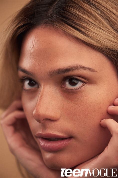 Meet 5 Models With Facial Scars Teen Vogue